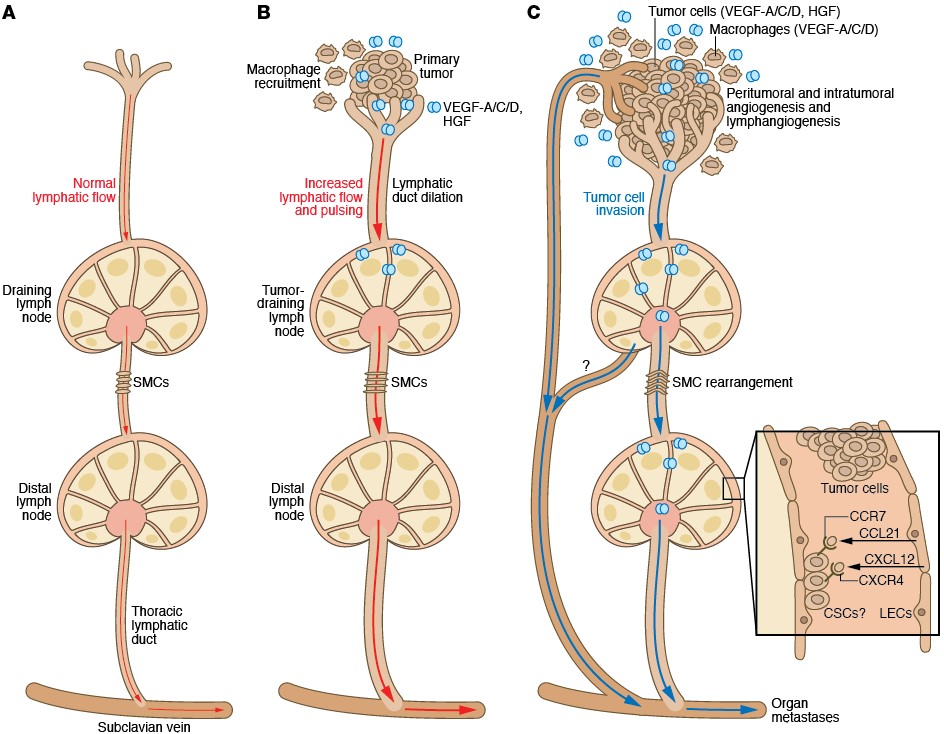 Enlarged view: Tumor Lymphangiogenesis